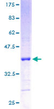 RPL5 (Human) Recombinant Protein (P01)