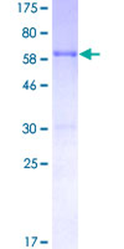 RP2 (Human) Recombinant Protein (P01)