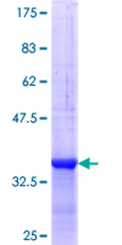 RNASE1 (Human) Recombinant Protein (Q01)