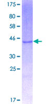 RNASE1 (Human) Recombinant Protein (P01)