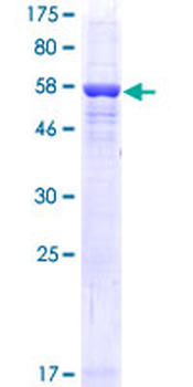 RLBP1 (Human) Recombinant Protein (P01)