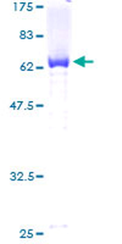 RCN1 (Human) Recombinant Protein (P01)