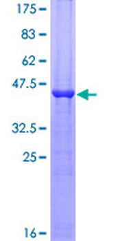 RBP4 (Human) Recombinant Protein (P01)