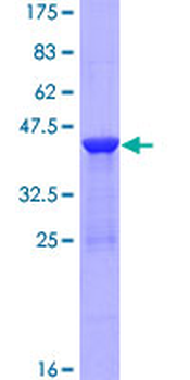 RBP2 (Human) Recombinant Protein (P01)