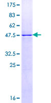 RALB (Human) Recombinant Protein (P02)