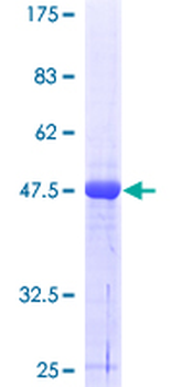 RALB (Human) Recombinant Protein (P01)