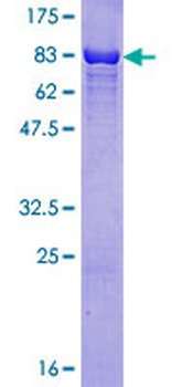 RAD23B (Human) Recombinant Protein (P01)