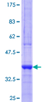 ABCD3 (Human) Recombinant Protein (Q01)