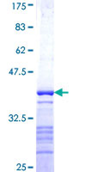 PTPRN (Human) Recombinant Protein (Q01)