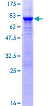 PTPN2 (Human) Recombinant Protein (P01)