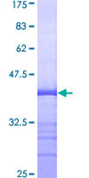 PTK7 (Human) Recombinant Protein (Q01)