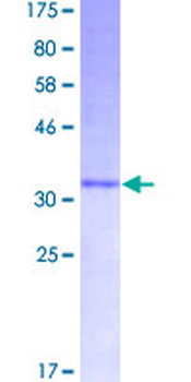PYY (Human) Recombinant Protein (P01)