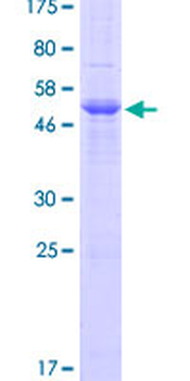 PRSS3 (Human) Recombinant Protein (P01)