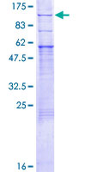 PRLR (Human) Recombinant Protein (P02)