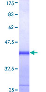 EIF2AK2 (Human) Recombinant Protein (Q01)