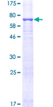 MAPK3 (Human) Recombinant Protein (P01)