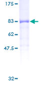 PPP5C (Human) Recombinant Protein (P01)