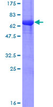 PPP2R4 (Human) Recombinant Protein (P01)