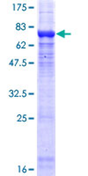 PPP2R2C (Human) Recombinant Protein (P01)