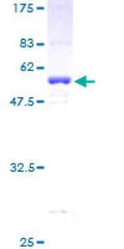 PPP1R8 (Human) Recombinant Protein (P01)