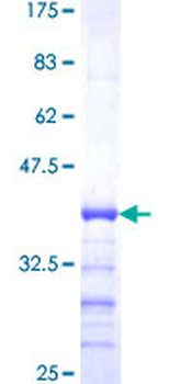 PPP1R2 (Human) Recombinant Protein (Q01)