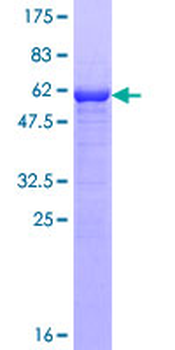 PPP1R2 (Human) Recombinant Protein (P01)