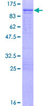 PPM1G (Human) Recombinant Protein (P02)