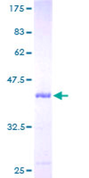 UBL3 (Human) Recombinant Protein (P01)