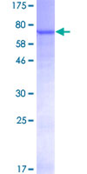 PNLIPRP2 (Human) Recombinant Protein (P01)