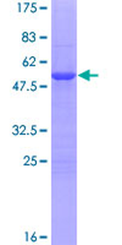 PRRX1 (Human) Recombinant Protein (P01)