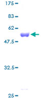 PMM2 (Human) Recombinant Protein (P01)