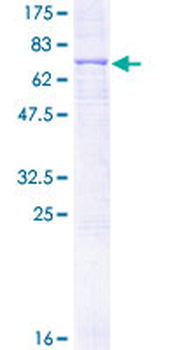 PLTP (Human) Recombinant Protein (P01)