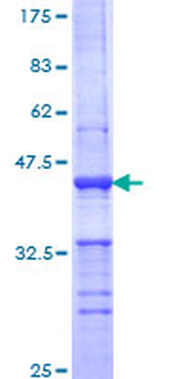 PLD1 (Human) Recombinant Protein (Q01)