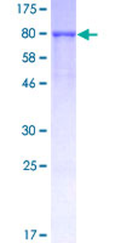 PIP (Human) Recombinant Protein (P01)