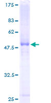 SERPINB5 (Human) Recombinant Protein (P01)