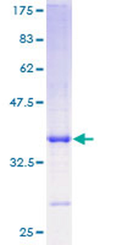 PI3 (Human) Recombinant Protein (P01)