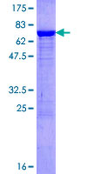 SERPINA1 (Human) Recombinant Protein (P02)