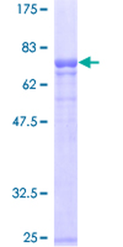 SERPINA1 (Human) Recombinant Protein (P01)