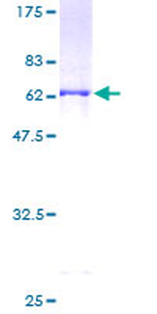PHYH (Human) Recombinant Protein (P01)