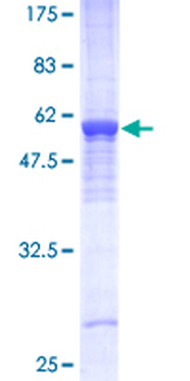 PHB (Human) Recombinant Protein (P01)
