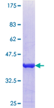 CFP (Human) Recombinant Protein (Q01)