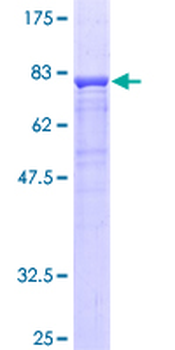 CFP (Human) Recombinant Protein (P01)