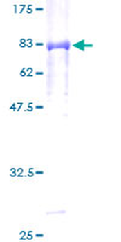 PEPD (Human) Recombinant Protein (P01)