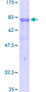 PECAM1 (Human) Recombinant Protein (P02)