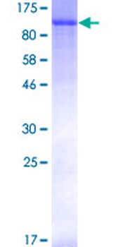 PECAM1 (Human) Recombinant Protein (P01)