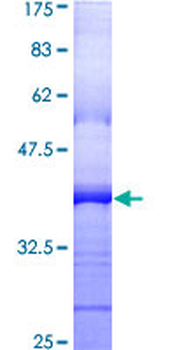 PDGFRB (Human) Recombinant Protein (Q01)