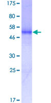 PDGFRA (Human) Recombinant Protein (P01)