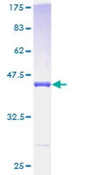 PDE6D (Human) Recombinant Protein (P01)