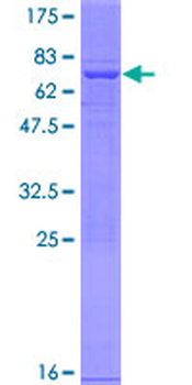PAFAH2 (Human) Recombinant Protein (P01)