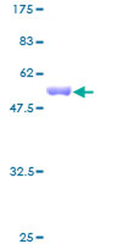 PAFAH1B3 (Human) Recombinant Protein (P01)